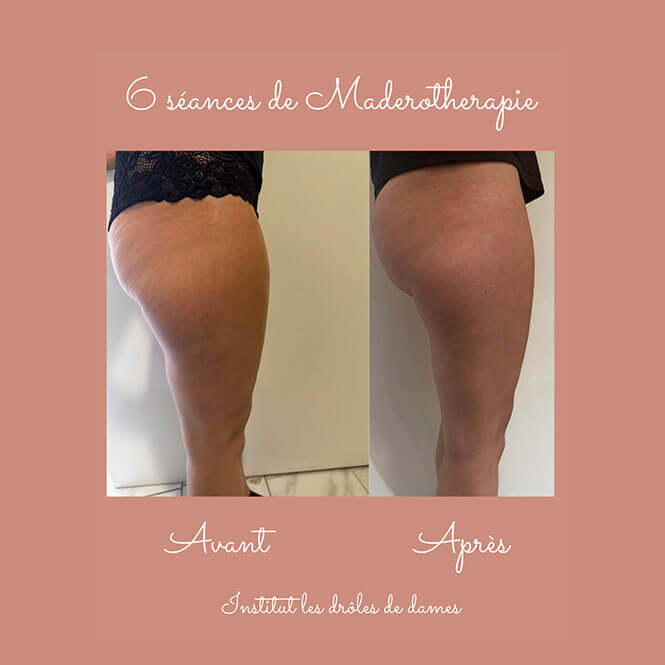 Madérothérapie Orliénas