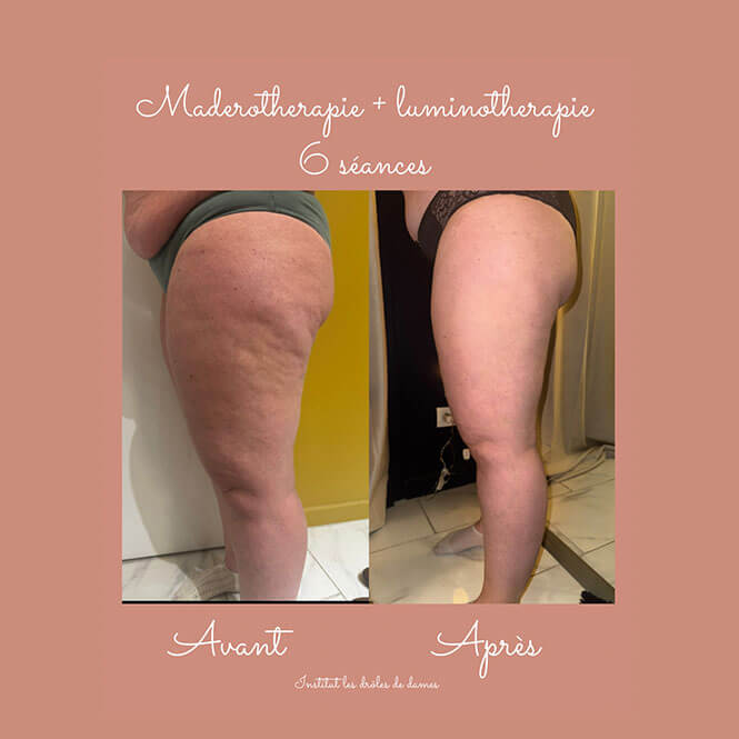 Madérothérapie Orliénas